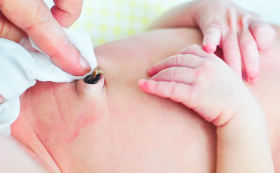 Cordón umbilical del bebe seco<br />
