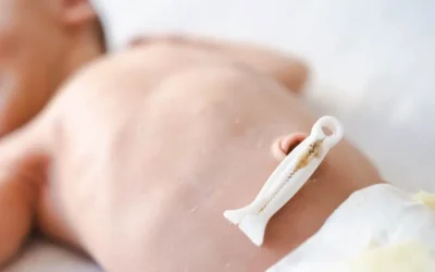 El Cuidado del Cordón Umbilical: Guía Sencilla para Padres Primerizos